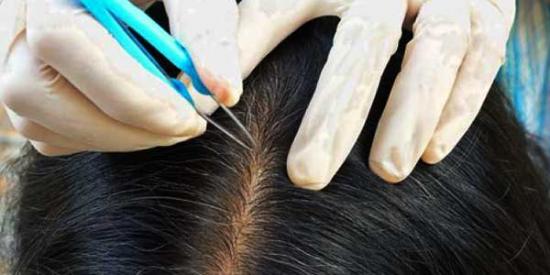 Rambut Bak Mahkota